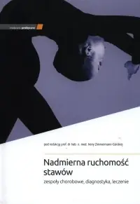 Nadmierna ruchomość stawów Okazja